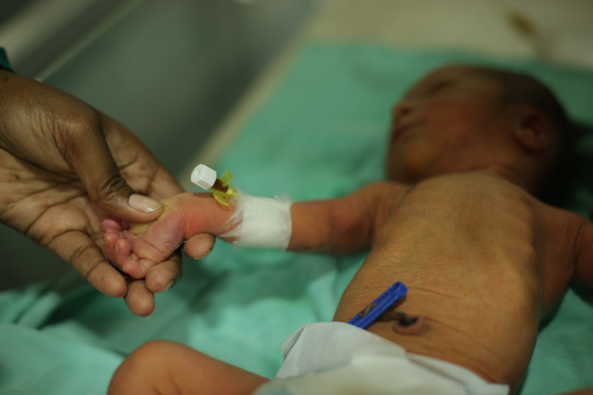 Most stillbirths in 2019 happened in India, estimates UN report